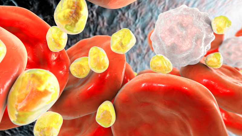 Trường hợp nào nên xét nghiệm cholesterol?