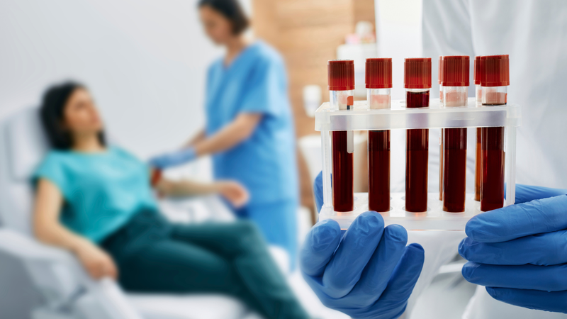 Chuẩn bị trước khi xét nghiệm