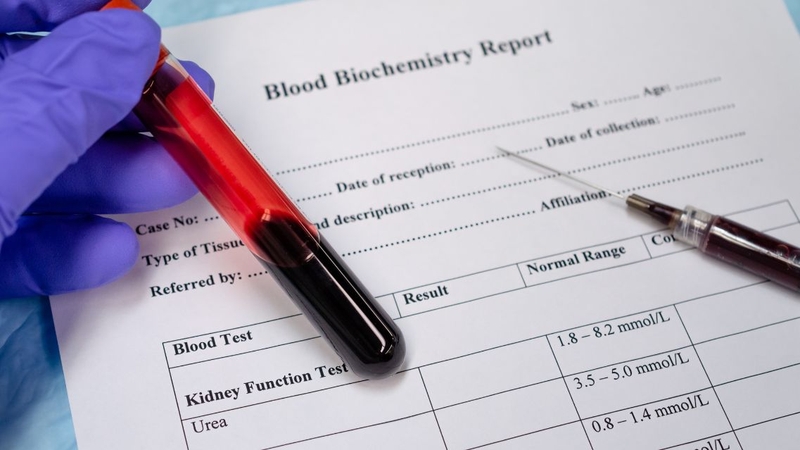 Xét nghiệm chức năng thận bao lâu có kết quả 1