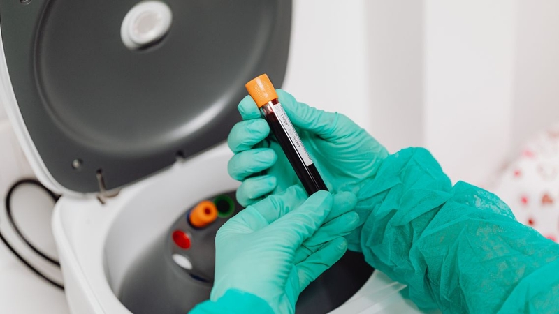 Có thể&nbsp;xét nghiệm công thức máu 18 thông số&nbsp;chủ động hoặc theo chỉ định