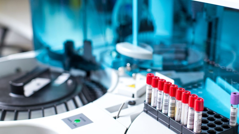 Cần xin tư vấn bác sĩ để kết quả xét nghiệm máu có độ chính xác cao