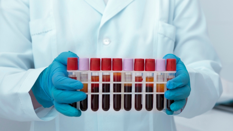 Chi phí xét nghiệm công thức máu còn tùy thuộc vào loại xét nghiệm thực hiện