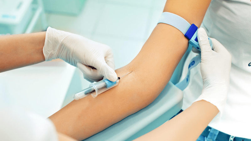 Xét nghiệm CPK có quan trọng không? Khi nào được chỉ định 4