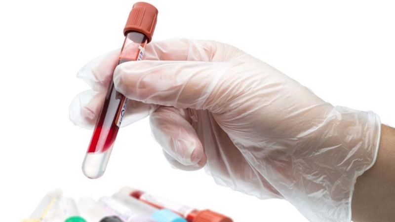 CRP là xét nghiệm thường được chỉ định nếu nghi ngờ nhiễm trùng