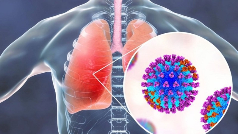 CRP tăng cao có thể là dấu hiệu cảnh báo bệnh viêm phổi