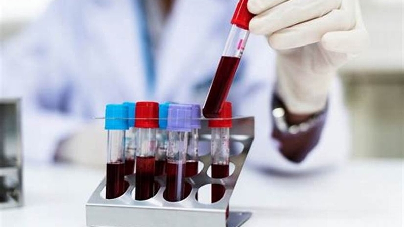 Xét nghiệm CTM: Giải pháp hiệu quả trong chẩn đoán bệnh lý 2