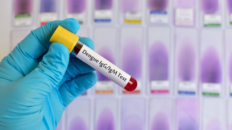 Xét nghiệm Dengue IgG ở đâu chất lượng? Các bệnh viện đa khoa tuyến tỉnh hoặc trung ương luôn là điểm đến được ưu tiên hàng đầu