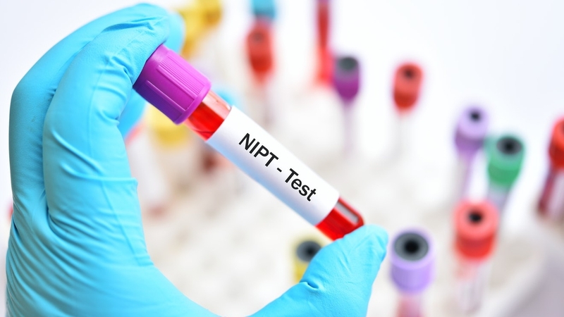 Có nên thực hiện xét nghiệm dị tật thai nhi tuần 12? 3