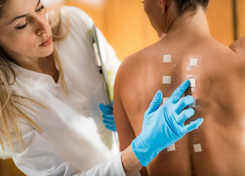 Xét nghiệm dị ứng bao nhiêu tiền? 4