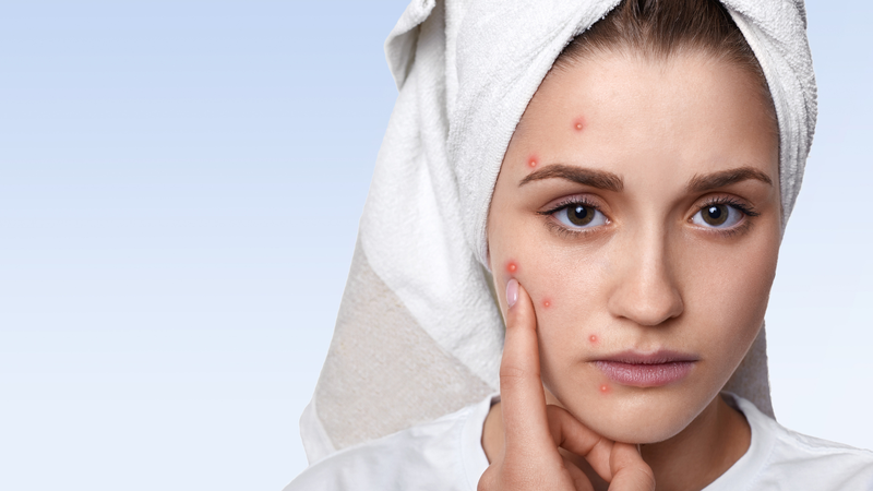 Dị ứng mỹ phẩm có thể gây kích ứng cho da