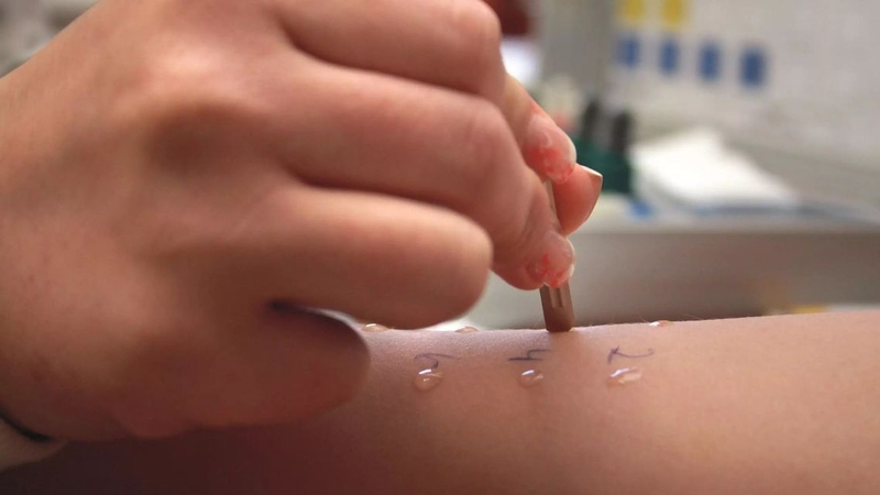 Test dị ứng thuốc cần được thực hiện tại cơ sở y tế có đủ phương tiện cấp cứu