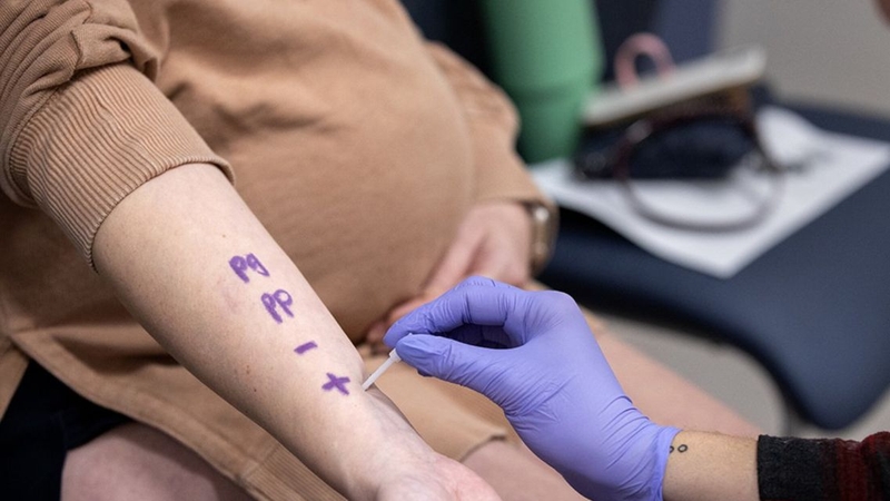 Mề đay, khó thở sau khi dùng kháng sinh nên được kiểm tra dị ứng