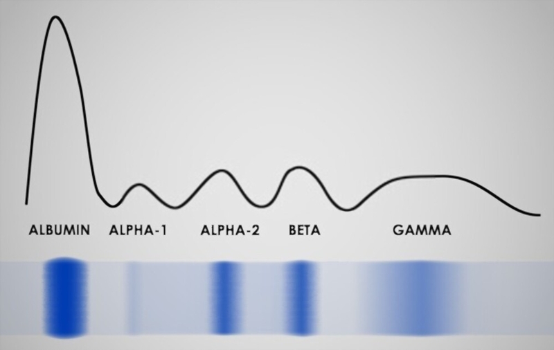 xet-nghiem-dien-di-protein-huyet-thanh-la-gi 1.jpg