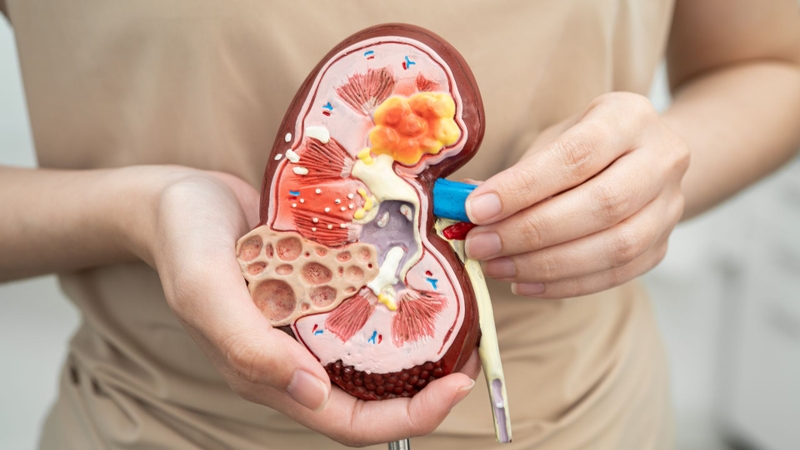 Xét nghiệm độ thanh thải Creatinin được dùng để chẩn đoán sớm các bệnh lý về thận