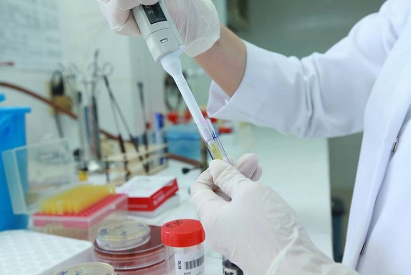 Nếu được chẩn đoán lao AFB âm tính, bệnh nhân cần được cách ly và thực hiện đúng phác đồ điều trị của bác sĩ