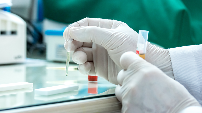 Xét nghiệm eGFR là gì? Công thức tính chỉ số eGFR không phải ai cũng biết 3