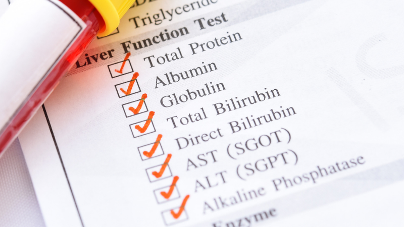 Xét Nghiệm Gan gồm những gì? Các Tiêu Chí Đánh Giá Rủi Ro và Phòng Ngừa Bệnh Gan 1