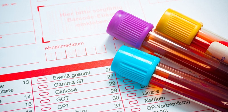 Xét nghiệm GGT là gì? Các biện pháp phòng ngừa chỉ số GGT tăng cao 1