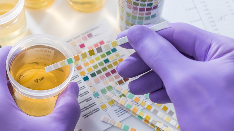 Xét nghiệm gì để biết suy thận: Tìm hiểu chi tiết 2