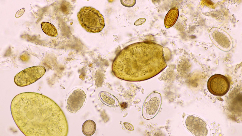 Xét nghiệm phân giúp phát hiện trứng giun đũa thông qua việc soi mẫu phân dưới kính hiển vi