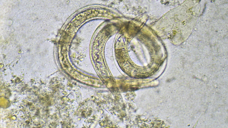 Thời gian trả kết quả tùy thuộc vào phương pháp xét nghiệm