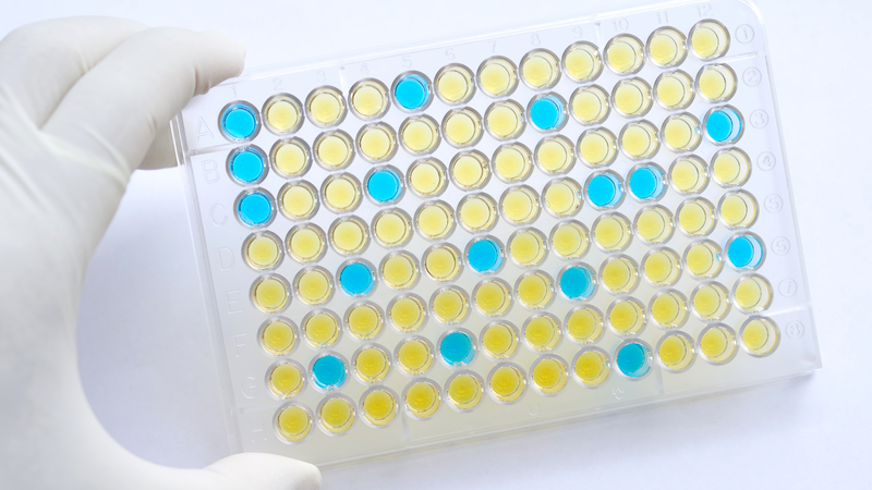 Xét nghiệm ELISA phát hiện kháng thể giun lươn trong máu là phương pháp hiệu quả nhất hiện nay