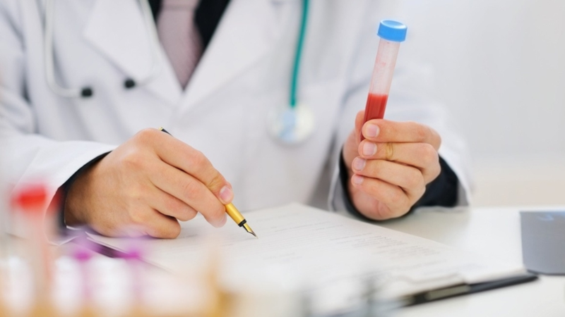 Xét nghiệm giun lươn bao lâu có kết quả? Thời gian trả kết quả phụ thuộc vào phương pháp xét nghiệm