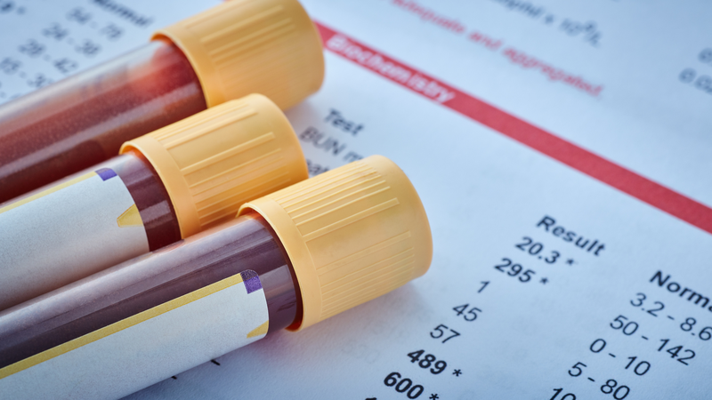 Xét nghiệm giun sán giá bao nhiêu? Chi phí tùy thuộc vào loại xét nghiệm và cơ sở y tế mà bạn lựa chọn