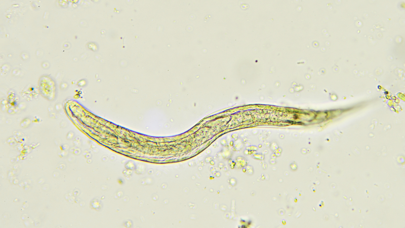 Tình trạng nhiễm giun sán là một vấn đề y tế cộng đồng phổ biến