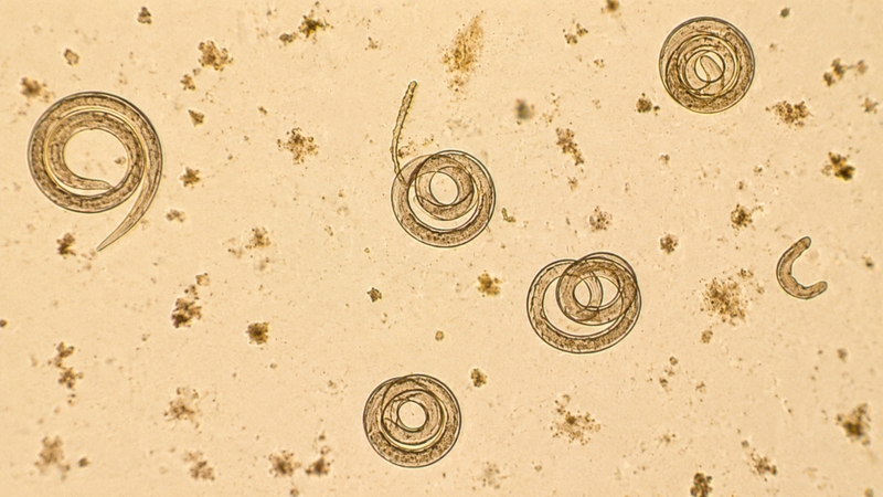 Giun xoắn (Trichinella) sau khi xâm nhập vào cơ thể có thể gây ra nhiều bệnh lý và biến chứng với mức độ khác nhau