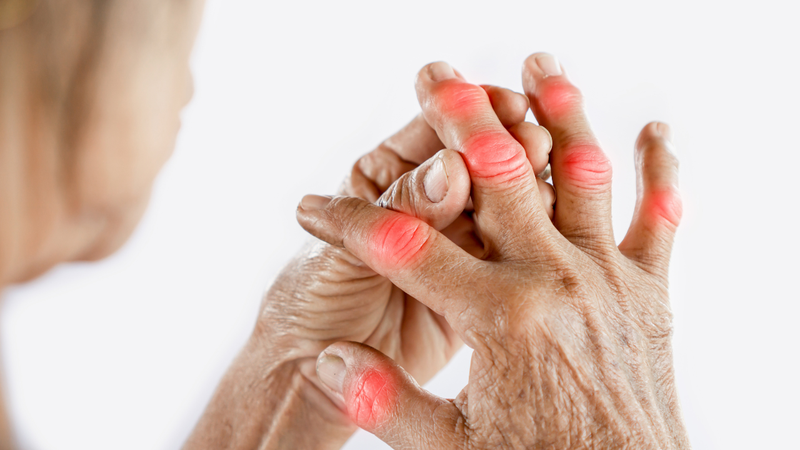 Đau khớp dữ dội, đột ngột có thể do bệnh gout