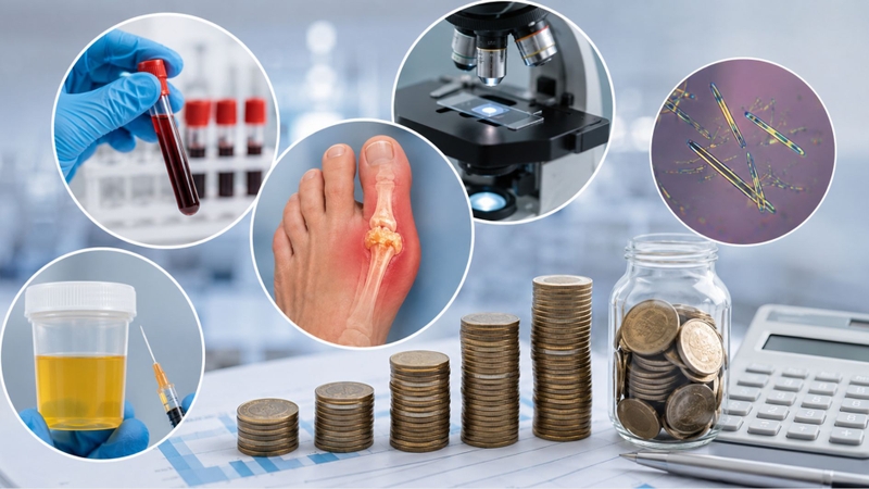 Chi phí xét nghiệm gout tùy vào loại xét nghiệm và cơ sở thực hiện