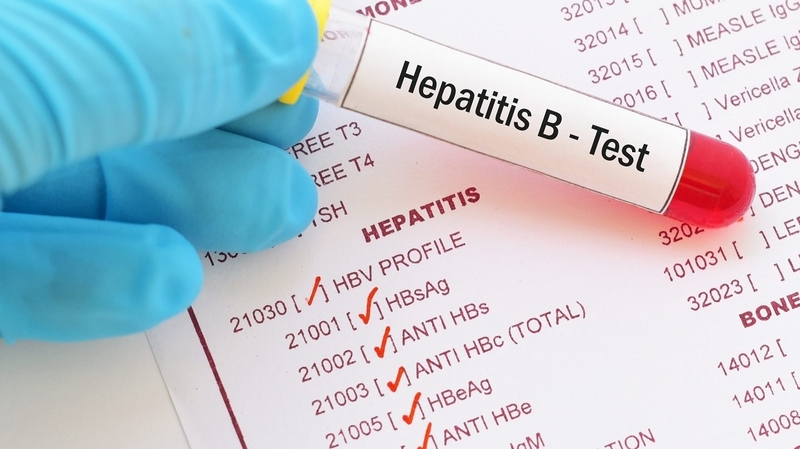 Xét nghiệm HBeAb dương tính thể hiện điều gì? 2