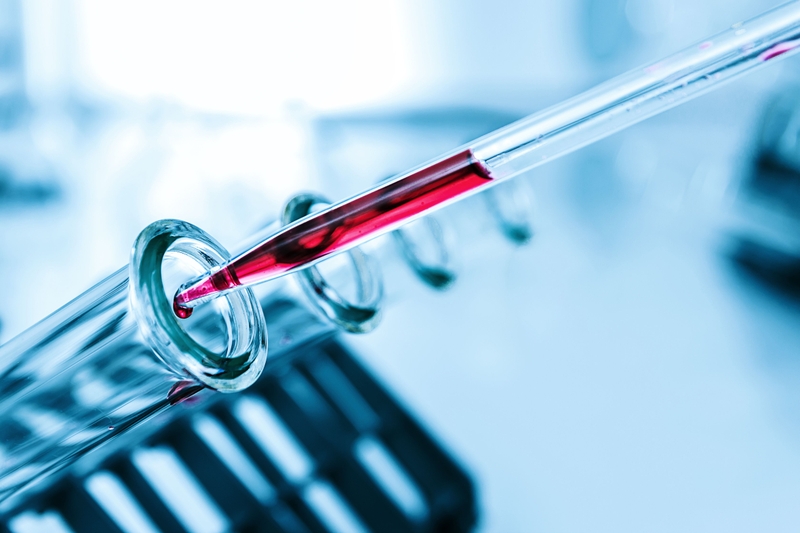 Xét nghiệm H. pylori IgG cho kết quả dương tính có ý nghĩa gì?