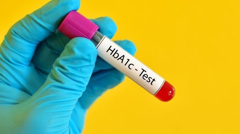 Xét Nghiệm HbA1c: Những điều cần biết để giám sát bệnh đái tháo đường hiệu quả 2