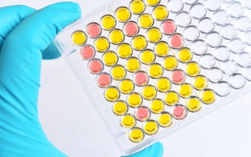 Xét nghiệm HIV được thực hiện như thế nào? Xét nghiệm HIV bao nhiêu tiền? 3