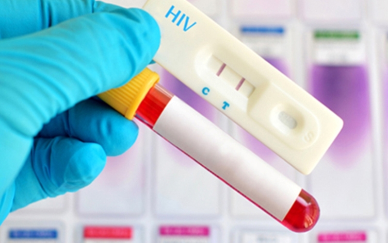 Xét nghiệm HIV được thực hiện như thế nào? Xét nghiệm HIV bao nhiêu tiền? 4