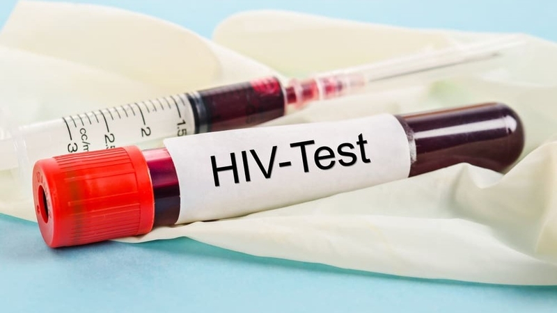 Xét nghiệm HIV khẳng định: Phương pháp xác định chính xác tình trạng nhiễm HIV 1