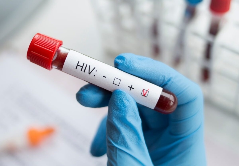 Xét nghiệm HIV khẳng định: Phương pháp xác định chính xác tình trạng nhiễm HIV 4