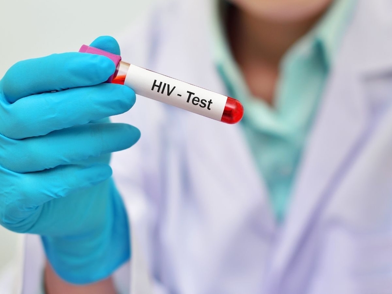 Xét nghiệm HIV ở đâu TPHCM? Thời điểm nào nên thực hiện xét nghiệm? 3