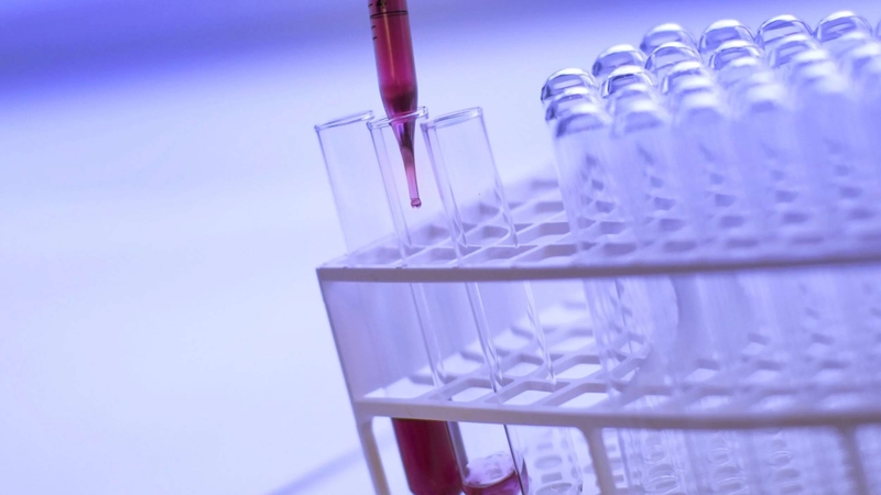 Xét nghiệm HIV sau 1 năm có chính xác không? Câu trả lời là có