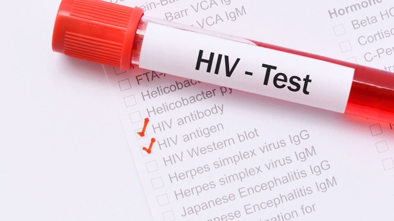 Tìm hiểu về các loại xét nghiệm HIV sau khi dùng PEP 4