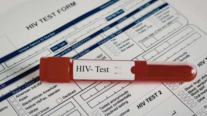 Xét nghiệm HIV bao nhiêu tiền phụ thuộc vào nhiều yếu tố