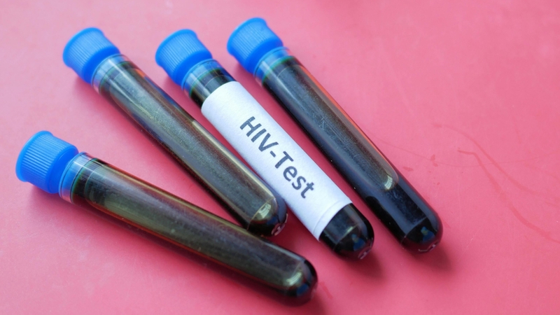 Xét nghiệm NAT (kỹ thuật khuếch đại axit nucleic) có chi phí cao hơn so với xét nghiệm kháng thể thông thường