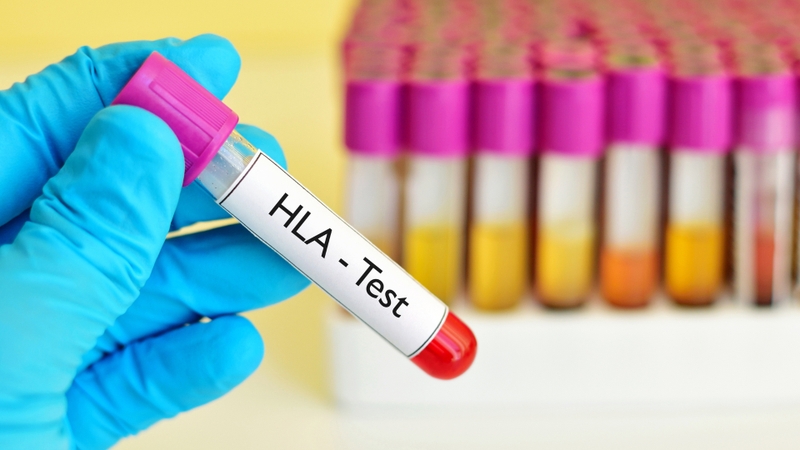 Xét nghiệm HLA là gì? Khi nào cần thực hiện xét nghiệm HLA? 5