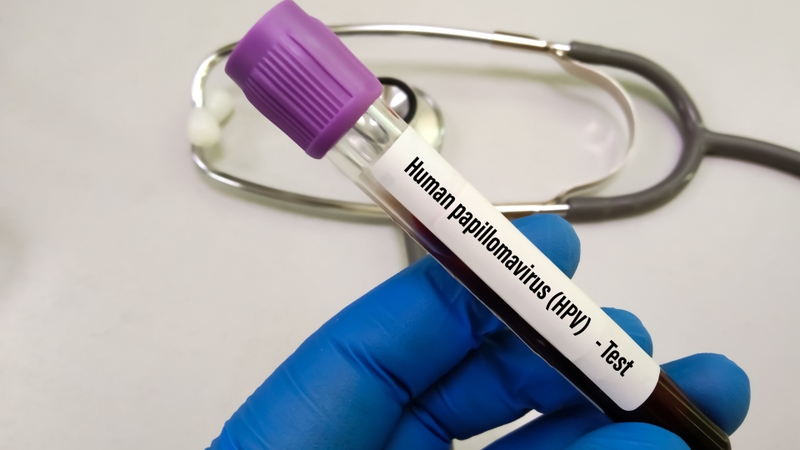 Xét nghiệm HPV có thể được hưởng bảo hiểm y tế (BHYT) trong một số trường hợp