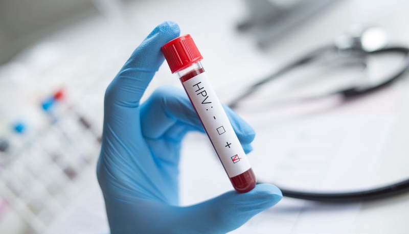 Xét nghiệm HPV cho nam ở đâu? Gợi ý các địa chỉ uy tín 4