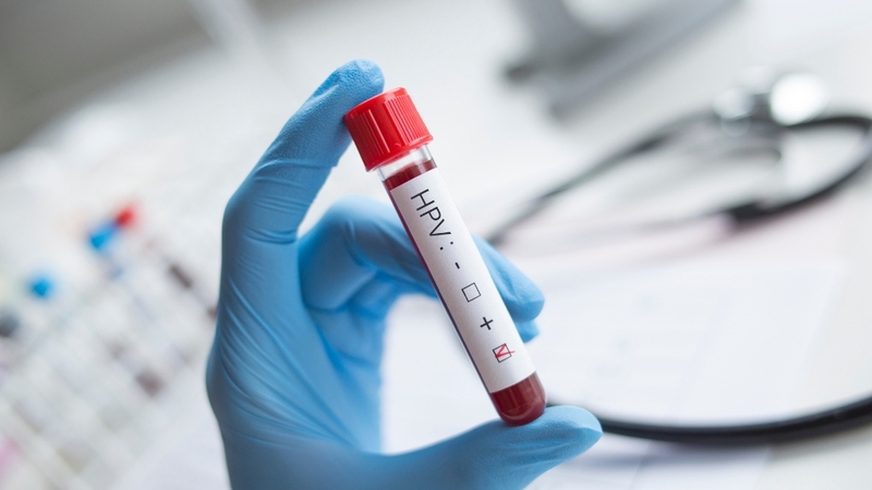 Xét nghiệm HPV ở đâu TPHCM? Địa chỉ uy tín và quy trình chi tiết bạn cần biết 1