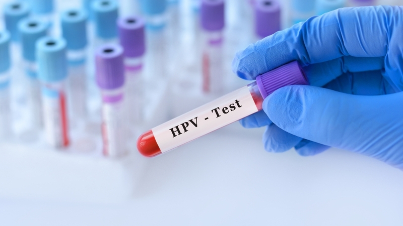Xét nghiệm HPV ở đâu TPHCM? Địa chỉ uy tín và quy trình chi tiết bạn cần biết 3