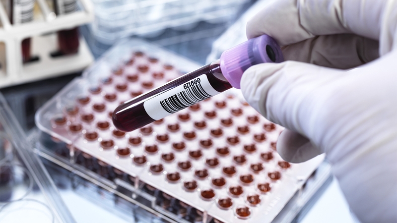 Xét nghiệm huyết thống thai nhi là gì? Quy trình xét nghiệm như thế nào? 4